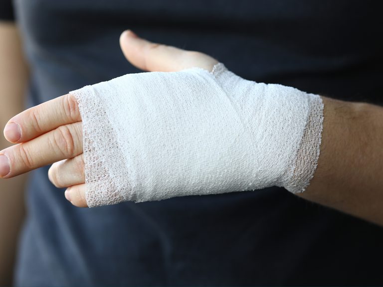 Hand injury